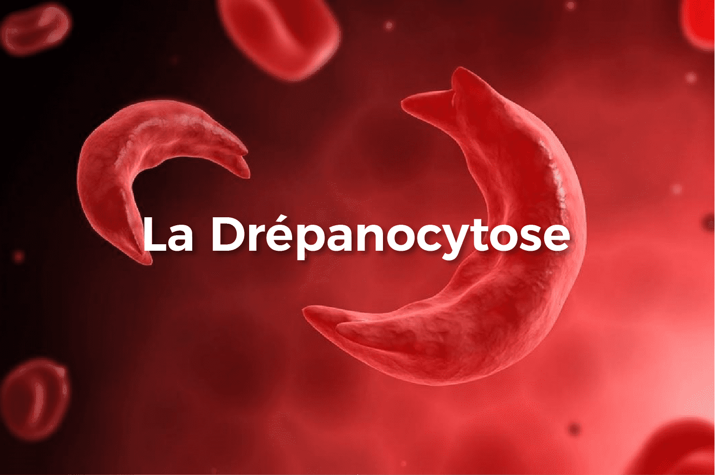 Lancement de notre première campagne sur la Drépanocytose